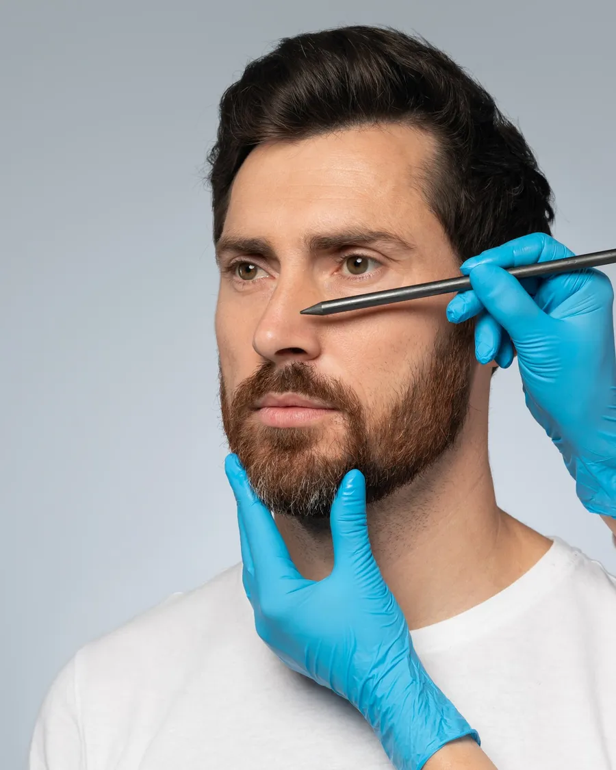 Barttransplantation mit FUE-Grafts bei AS Clinic Berlin